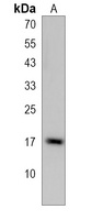 RAB19 Rabbit Polyclonal Antibody