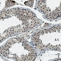BRD9 Rabbit Polyclonal Antibody