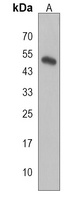 ASAHL Rabbit Polyclonal Antibody