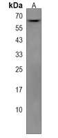 ZNF768 Rabbit Polyclonal Antibody