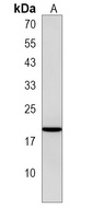 IFN alpha 5 Rabbit Polyclonal Antibody