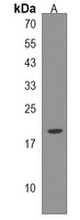GAGE3 Rabbit Polyclonal Antibody