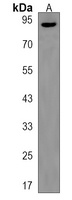 EXD3 Rabbit Polyclonal Antibody