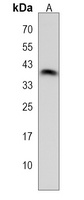 ZNF488 Rabbit Polyclonal Antibody