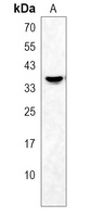 OR2AG2 Rabbit Polyclonal Antibody