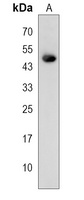 Serpin B11 Rabbit Polyclonal Antibody