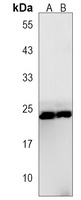RGS19 Rabbit Polyclonal Antibody