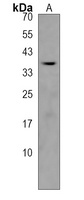 OR10AD1 Rabbit Polyclonal Antibody