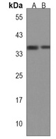 OR1F1 Rabbit Polyclonal Antibody