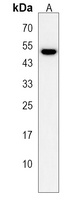 MTL5 Rabbit Polyclonal Antibody