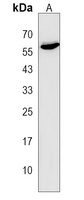 ONECUT3 Rabbit Polyclonal Antibody
