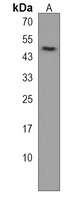 IP6K3 Rabbit Polyclonal Antibody