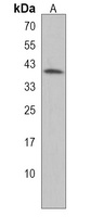 GPR88 Rabbit Polyclonal Antibody