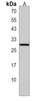 CGB2 Rabbit Polyclonal Antibody