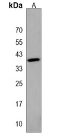 HLA-C Rabbit Polyclonal Antibody
