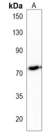 TMC4 Rabbit Polyclonal Antibody