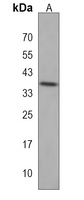 ZNF385A Rabbit Polyclonal Antibody
