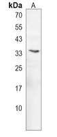 HOXD9 Rabbit Polyclonal Antibody