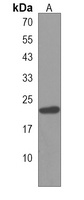 HOXB6 Antibody
