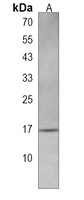 IGF2-AS Rabbit Polyclonal Antibody