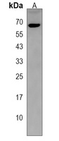 TRIM75 Rabbit Polyclonal Antibody