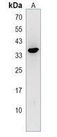 WBP2NL Rabbit Polyclonal Antibody