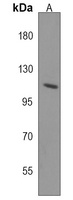 PHF20L1 Rabbit Polyclonal Antibody