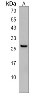 NKX6-3 Rabbit Polyclonal Antibody
