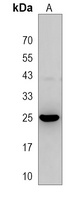 MOSPD3 Rabbit Polyclonal Antibody