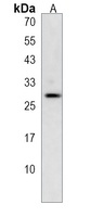 CLEC9A Rabbit Polyclonal Antibody