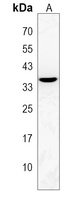 OR2L8 Rabbit Polyclonal Antibody