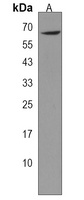 KLHL2 Rabbit Polyclonal Antibody