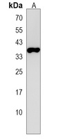 ZC2HC1A Rabbit Polyclonal Antibody
