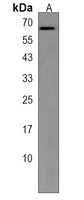Reticulon 2 Rabbit Polyclonal Antibody