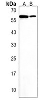 ZBTB22 Rabbit Polyclonal Antibody