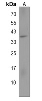 ZNF322 Rabbit Polyclonal Antibody