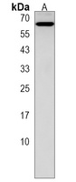 KLHL12 Rabbit Polyclonal Antibody