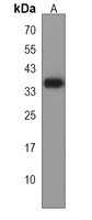 SBK2 Antibody
