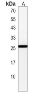 HEBP1 Rabbit Polyclonal Antibody