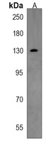 SALL1 Rabbit Polyclonal Antibody