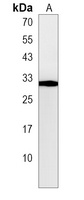 SAP30 Rabbit Polyclonal Antibody