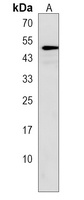 PRAMEF14 Rabbit Polyclonal Antibody