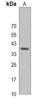 Selenoprotein P Rabbit Polyclonal Antibody