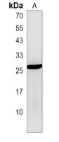PTTG2 Antibody