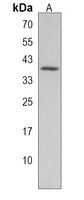 TAS2R7 Rabbit Polyclonal Antibody
