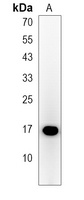 HMGN3 Rabbit Polyclonal Antibody