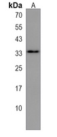 SULT1B1 Rabbit Polyclonal Antibody