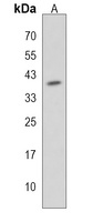 WNT6 Rabbit Polyclonal Antibody