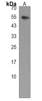 KLHDC4 Rabbit Polyclonal Antibody