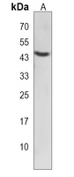 NET Rabbit Polyclonal Antibody